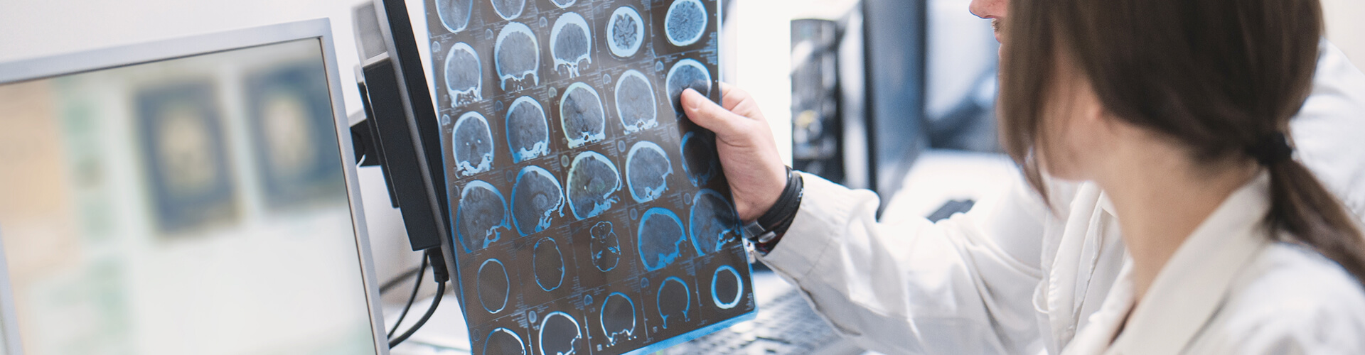Diagnóstico del Alzheimer